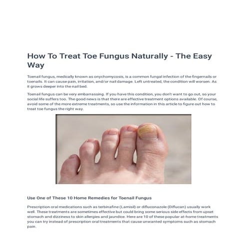 How To Treat Toe Fungus Naturally - The Easy Way
