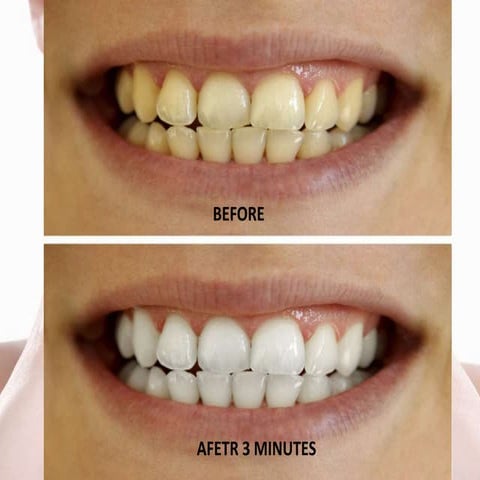 How to whiten your teeth at home naturally
