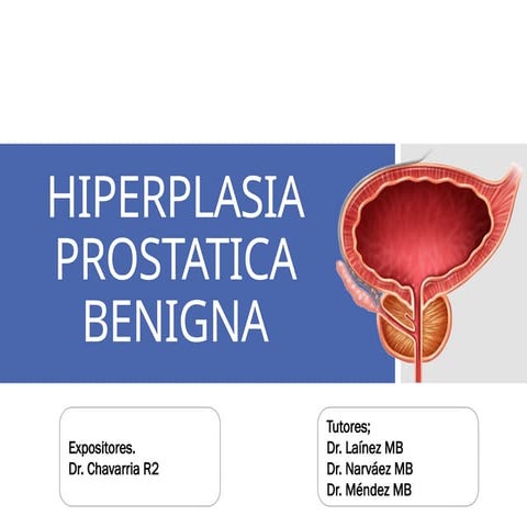 Hiperplasia prostatica. | PPTX