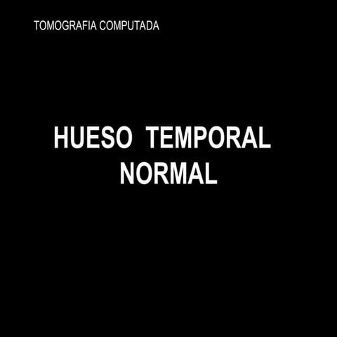 HUESO TEMPORAL NORMAL ANATOMIA Y RADIOLOGIA PATOLOGICA | PPT