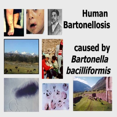 Human Bartonellosis