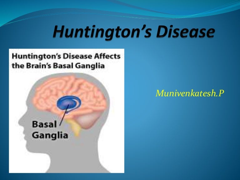 Huntington