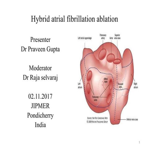 Hybrid atrial fibrillation ablation