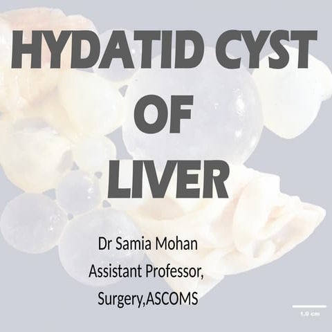 hydatid CLINICAL PICTURE AND TREATMENT.pptx