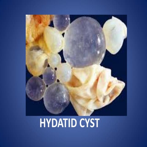 Hydatid cyst