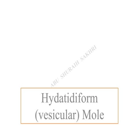 Hydatidiform mole/ VESICULAR MOLE