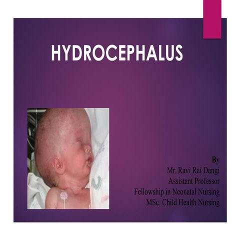Hydrocephalus