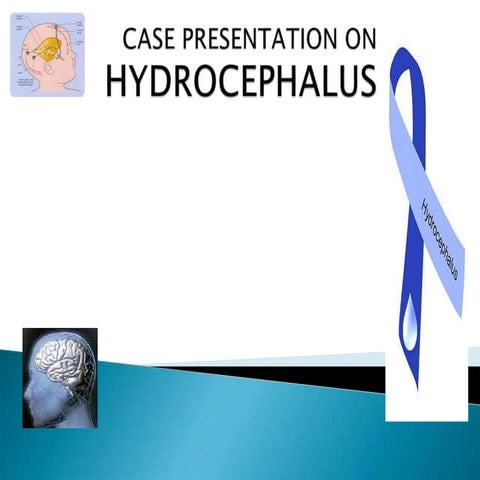 Hydrocephalus - Case Presentation (2).ppt