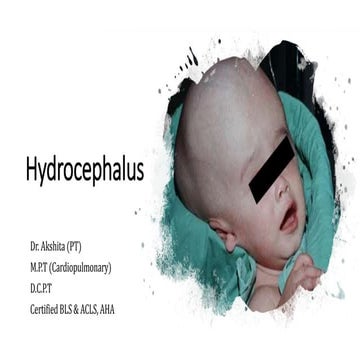 Hydrocephalus (1) (2)