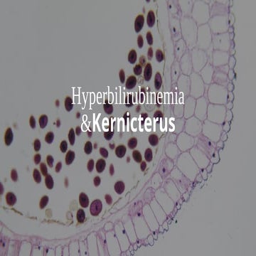 Hyperbilirubinemia ,Kernicterus , bilirubin encephalopathy | PPTX