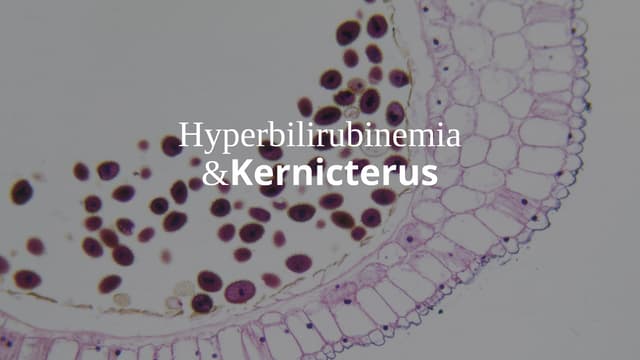 Pediatric seminar (Kernicterus).pptx....... | PPTX