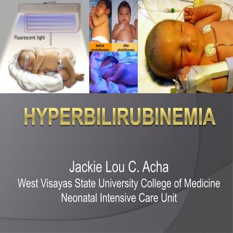 Hyperbilirubinemia 