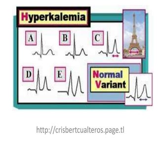 Hyperkalemia