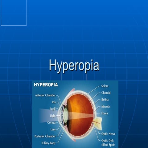Hyperopia