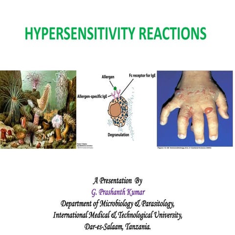 Hypersensitivity