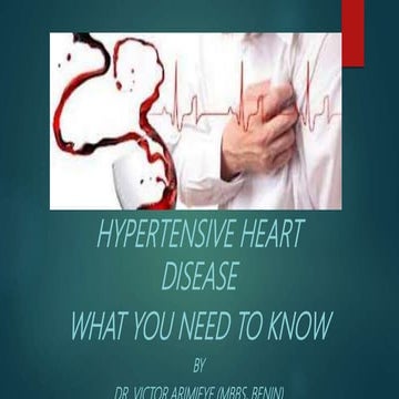 Right and left ventricular hypertrophy | PPT