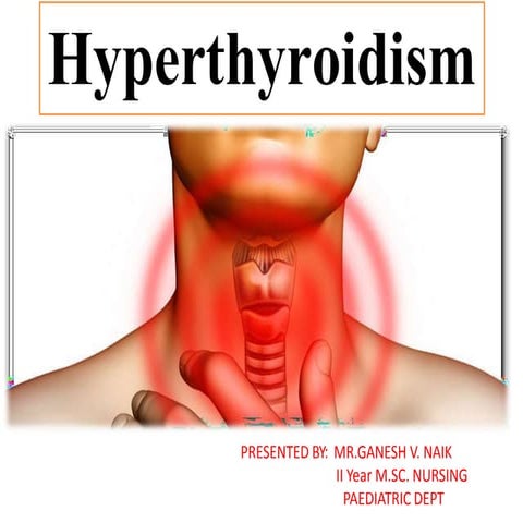 Hyperthyroidism