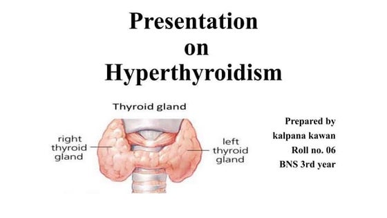 Hyperthyroidism | PPT