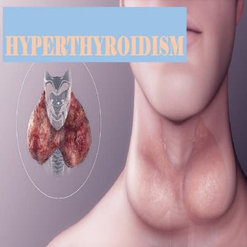 thyroid disorder hyperthyroidism disorder.pptx