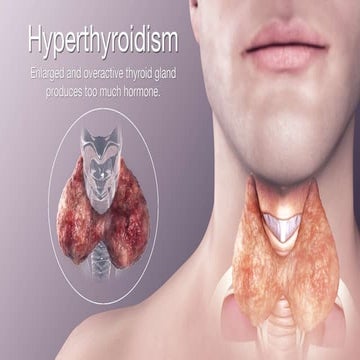 Hyperthyroidism & hypothyroidism