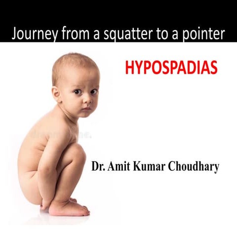 Hypospadias