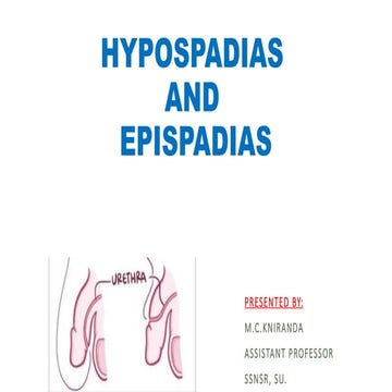 hypospadias/hypospadias in children.pptx