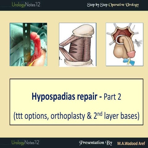 Hypospadias 3: MAGPI & snod grass (TIP) step by step operative urology ...