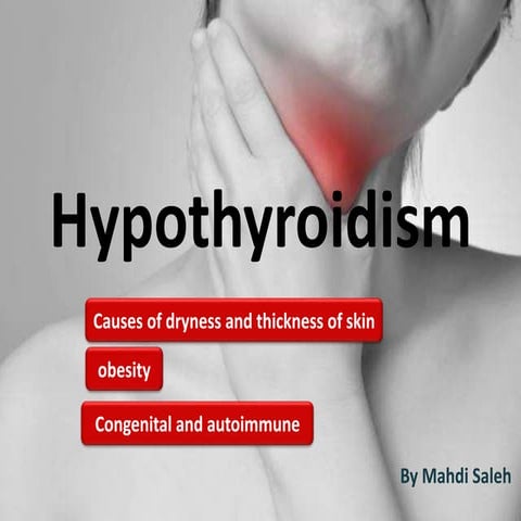 Hypothyroidism