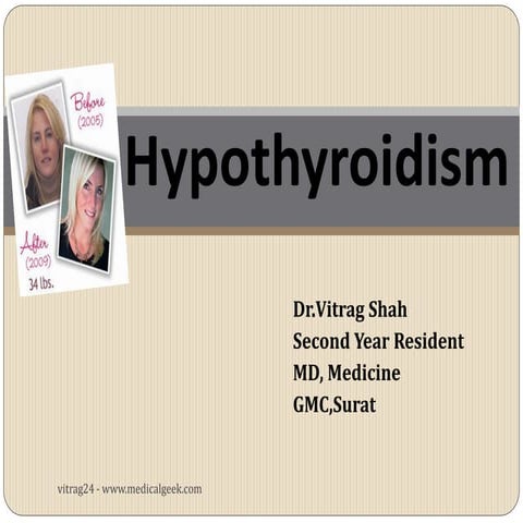 Hypothyroidism