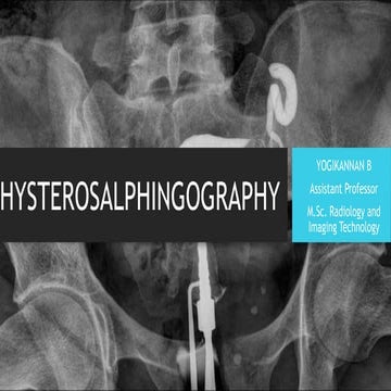 HYSTEROSALPHYNGOGRAPHY HYSTEROSALPHYNGOGRAPHY.pptx