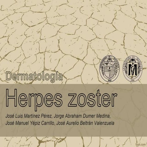 Herpes Zoster