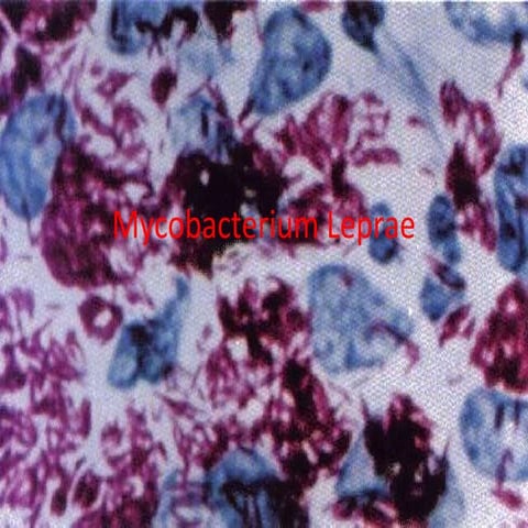 [Micro] mycobacterium leprae