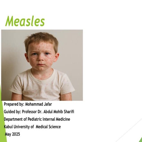 Measles(introduction,  Epidemiology Etiology , Pathophsyalogy....presentation