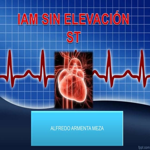 INFARTO AGUDO DE MIOCARDIO SIN ELEVACIÓN DEL SEGMENTO ST.