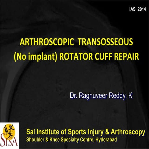 Arthroscopic Transosseous(No Implant) Rotator Cuff Repair-Dr. Raghuveer Reddy .K