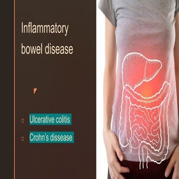 IBD-1.pptx