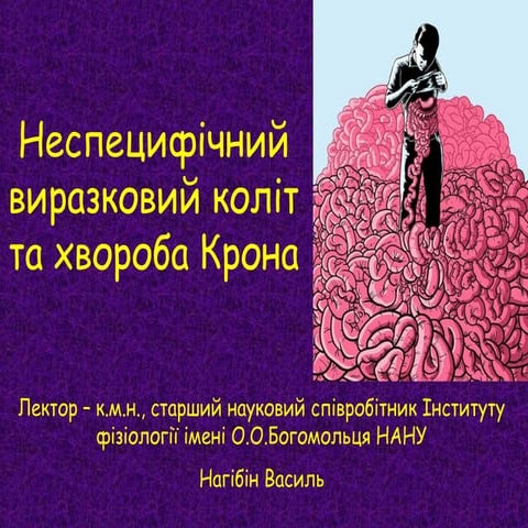 Хвороба Крона та неспецифічний виразковий коліт