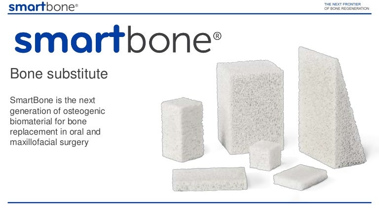 smartbone