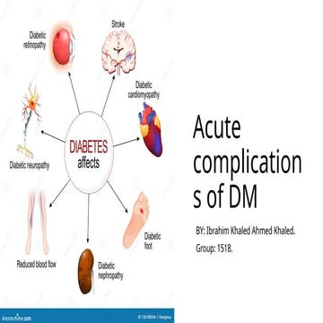 Acute complications of diabetes mellitus | PPTX