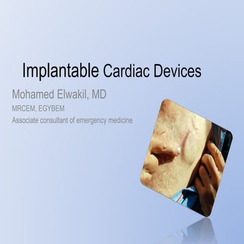 Implantable Cardiac Devices 