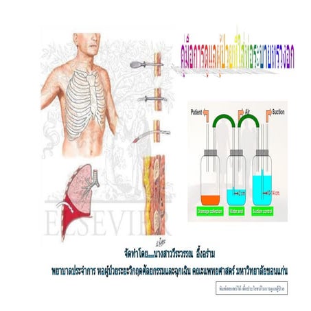 คู่มือ ICD (Chest drain)