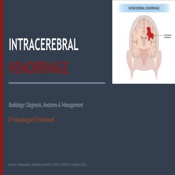 Intracerebral Hemorrhage Case presentation | PPTX