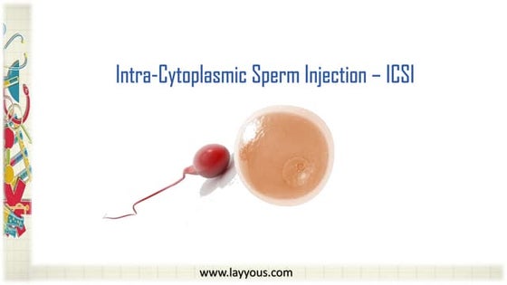 Intracytoplasmic sperm injection(2) | PPT