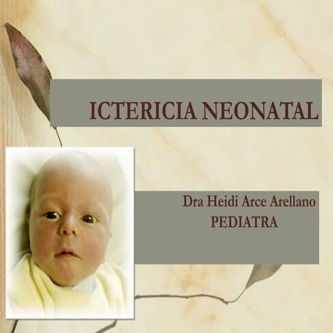 ictericia neonatffffffffffffffal (1).ppt
