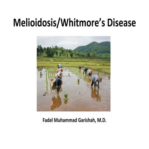 Melioidosis, Whitmore's disease