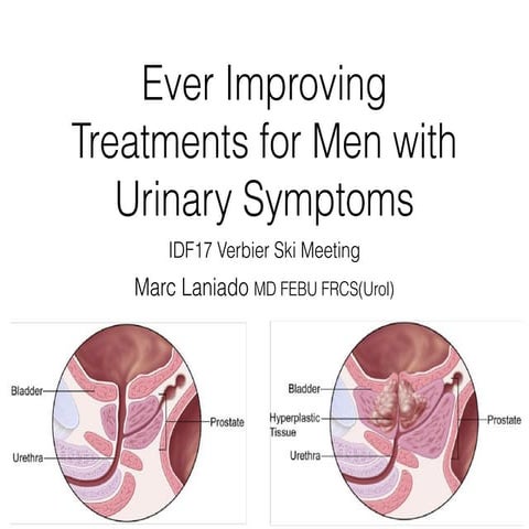 BPH treatments that safer, preserve ejaculation and help urinary symptoms due...