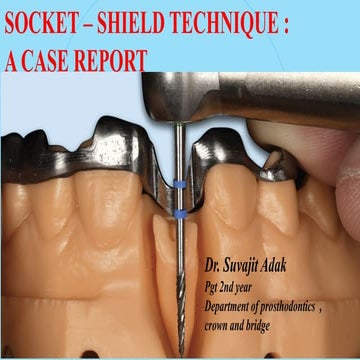 The socket-shield technique (SST).pptx
