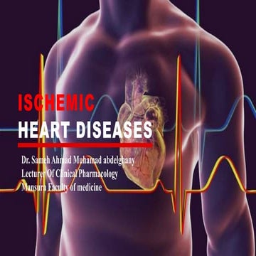 Management of Ischemic heart diseases
