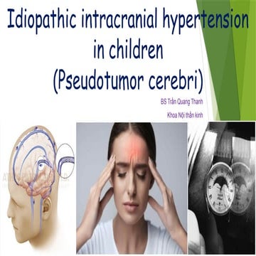 Idiopathic Intracranial Hypertension | PPTX