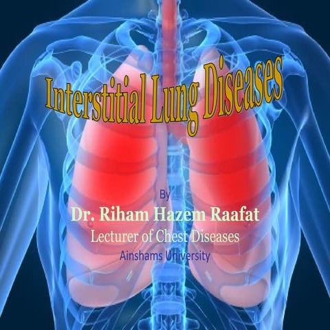 Interstitial Lung Diseases